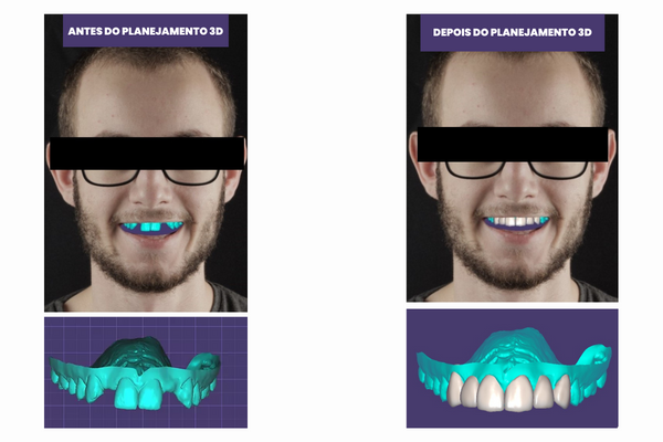 Tecnologia 3D