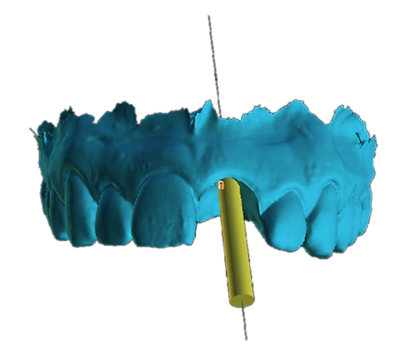 Cirurgia Guiada 3D