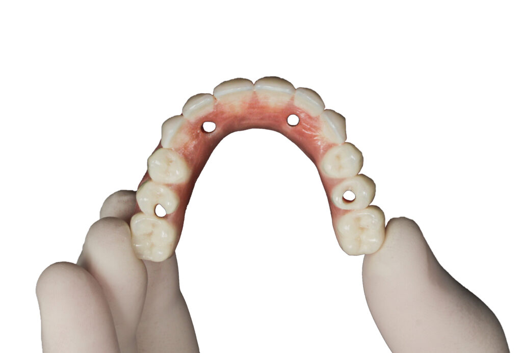 Vista Oclusal
